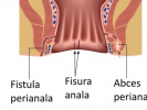 Poza