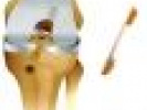 Poza