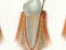 Poza