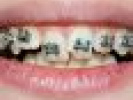 Poza