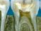 Poza