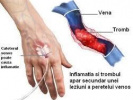 Poza