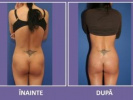 Poza